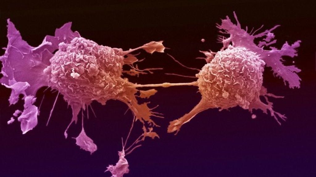 Scientists find antibody that hinders the spread of certain cancer cells...