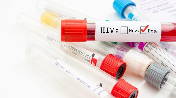 HIV spread earlier than believed; ‘Patient 0’ a myth, study says...