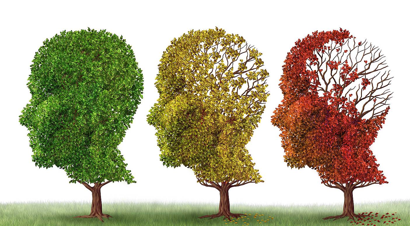 Nuevo descubrimiento que podría revertir la pérdida de la memoria por el Alzheimer...