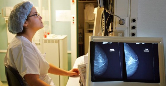 La doble mastectomía preventiva reduce el riesgo de muerte en cáncer de mama...