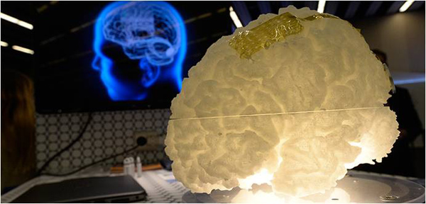 Un implante de grafeno revela la actividad oculta del cerebro...