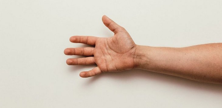13 tetrapléjicos recuperan la función de brazos y manos mediante transferencia de nervios...