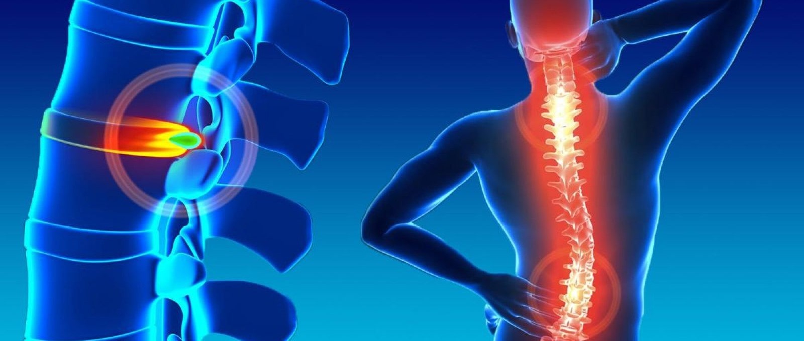 Se estudia cómo regenerar una lesión de médula espinal...