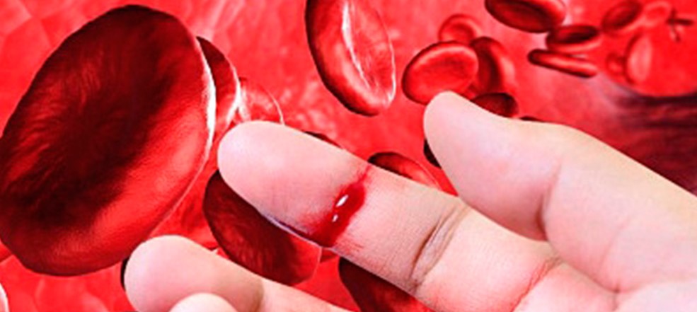 Online course on the management of hemophilia...