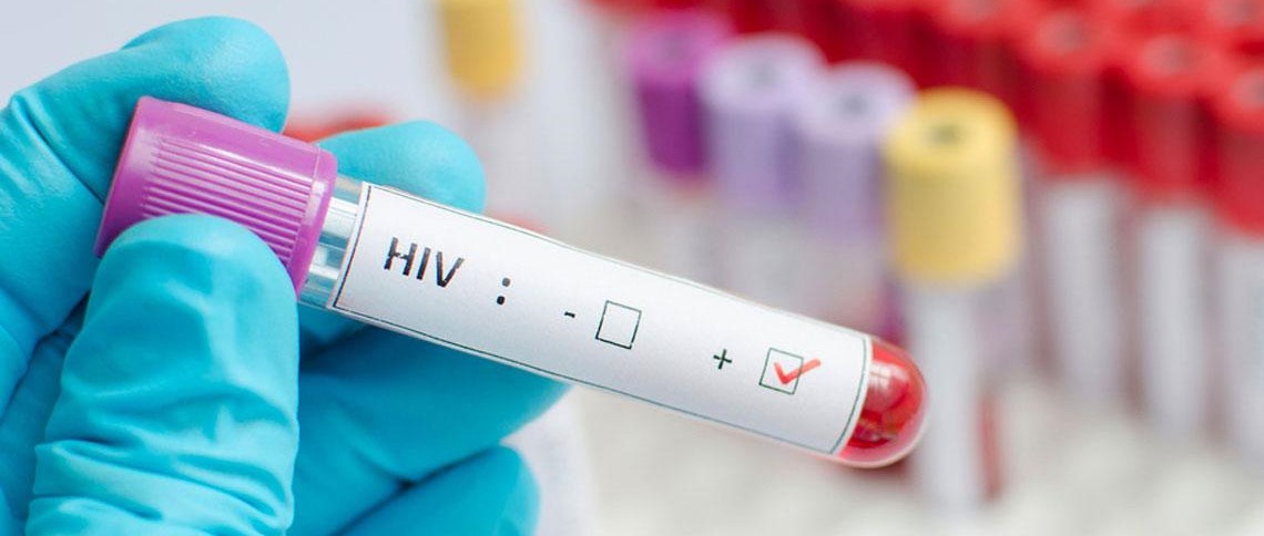 La pandemia del Covid-19 complica el reto de acabar con el sida para 2030...