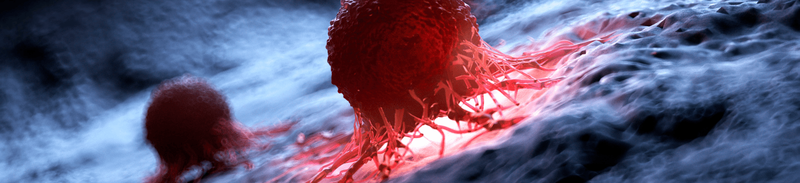 ¿Qué hace que unas células hagan metástasis en cáncer y otras no?...