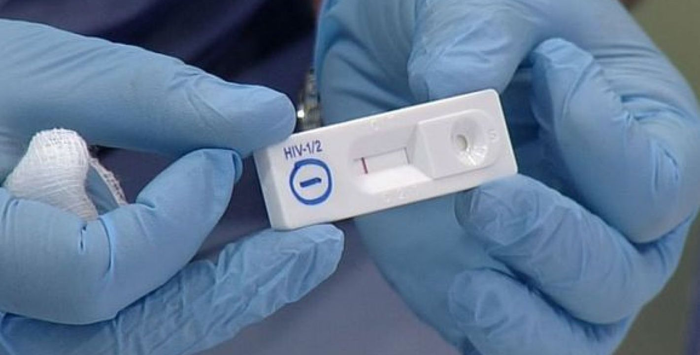 El test del VIH se podrá comprar en farmacias sin prescripción médica...
