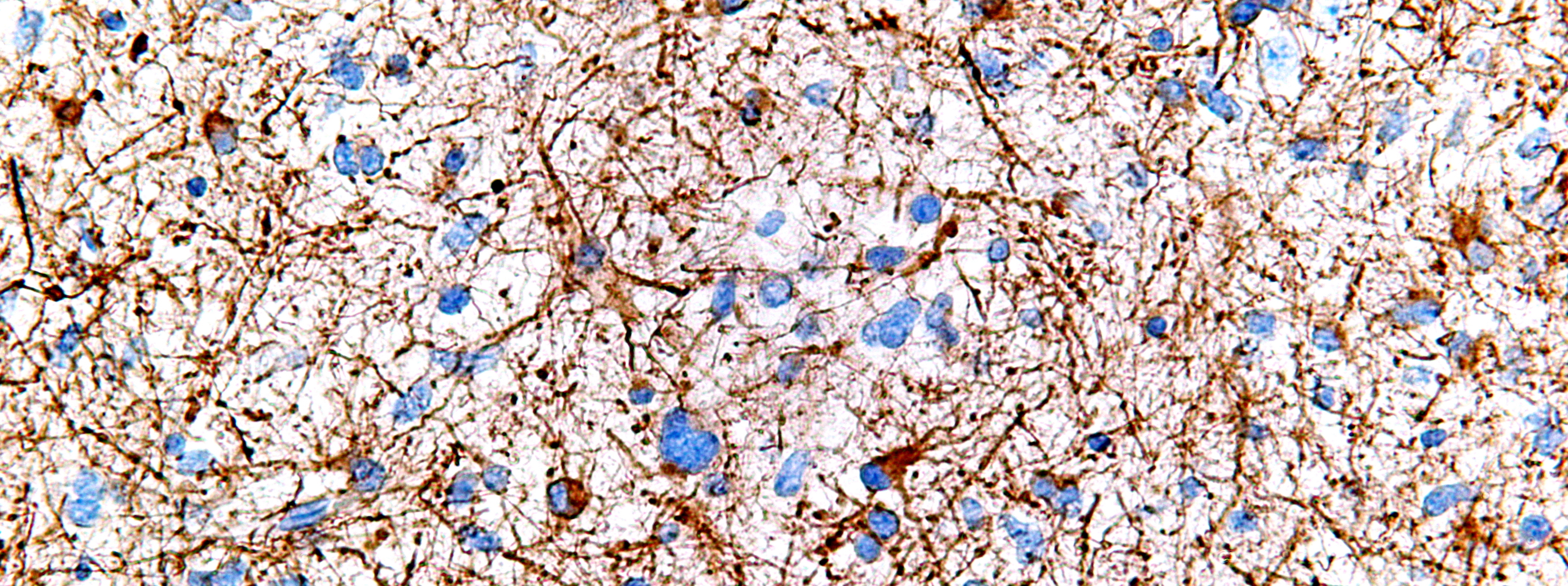Las células gliales defectuosas se vinculan al Parkinson...