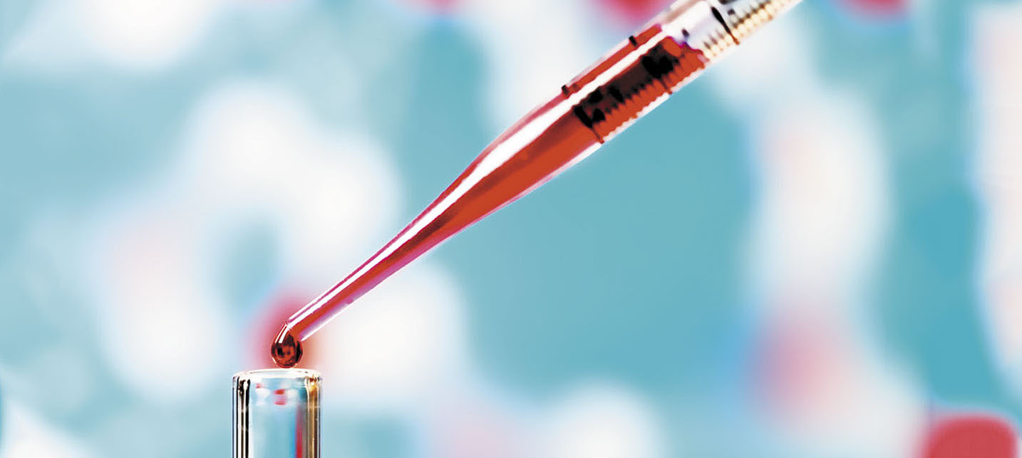 Nuevos datos avalan la biopsia líquida para diagnóstico temprano de cánceres de mama, ovario y ce...