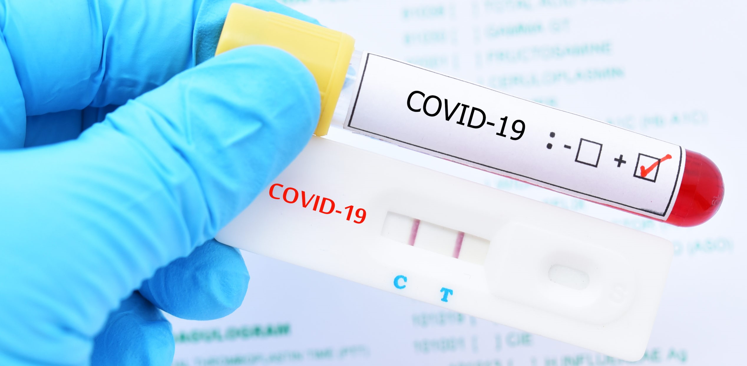 Las personas con VIH no tienen un mayor riesgo de covid-19 que la población general...