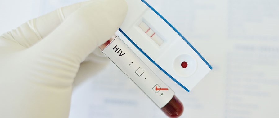 Una nueva vía deja al VIH indefenso ante el sistema inmune...