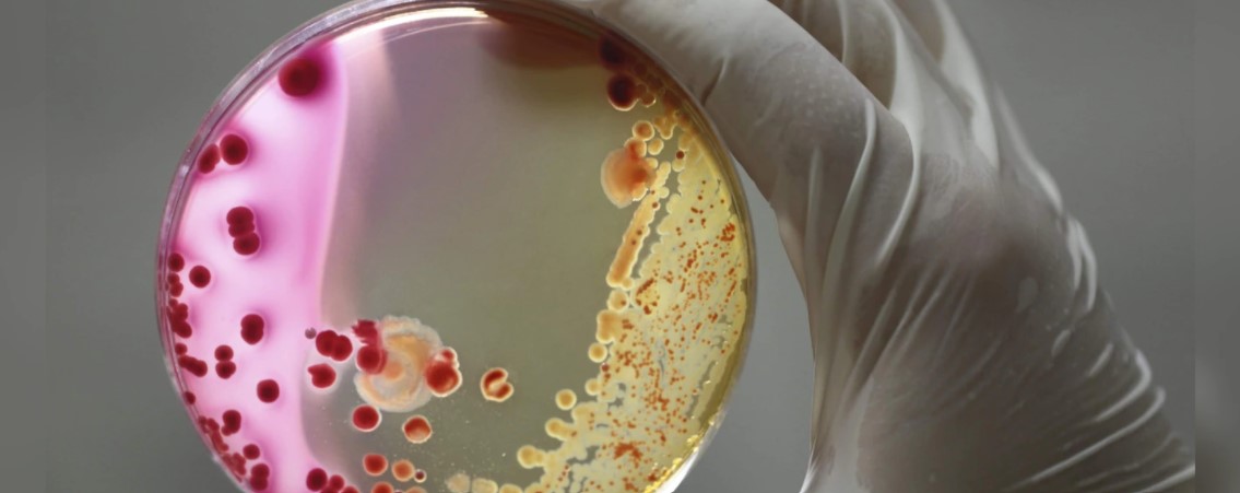 Las bacterias superresistentes mataron en 2019 a más personas que el cáncer y el sida juntos...