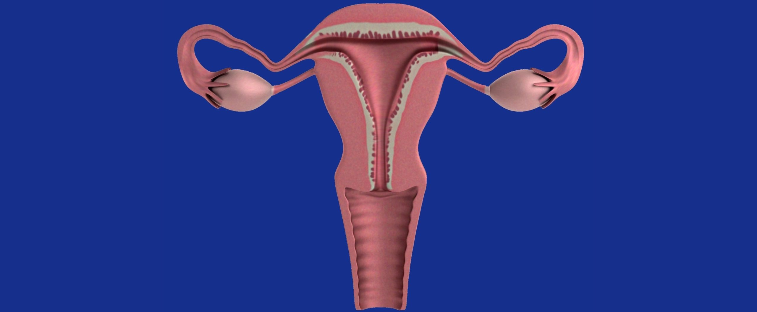 <strong>Endometriosis: su posible relación con el sistema inmunitario</strong>...