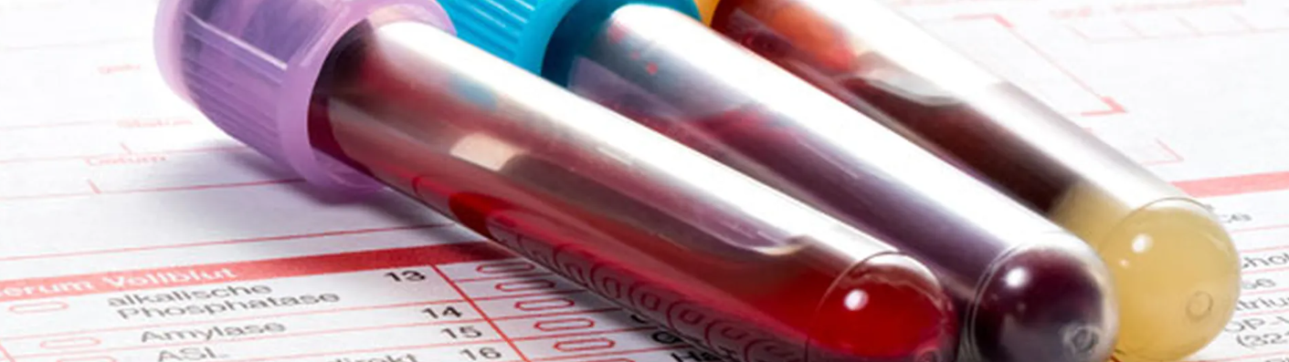 Un análisis de sangre detecta de forma precoz el cáncer de colon...